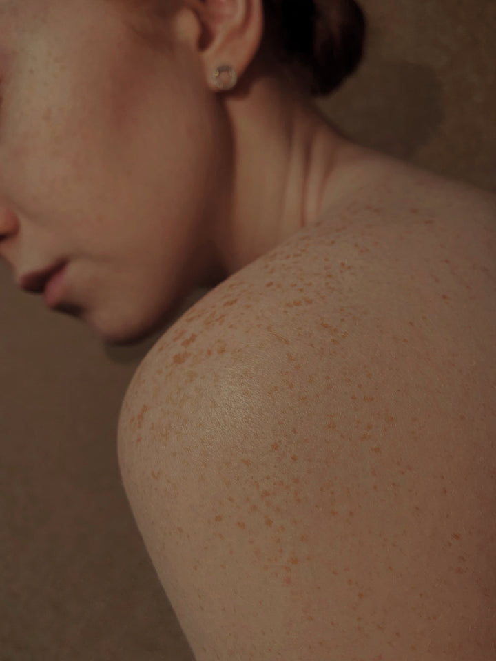 Woman's back with freckles 